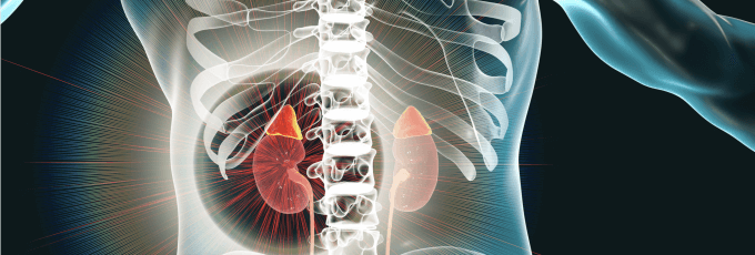 Building a Comprehensive Kidney Care Model